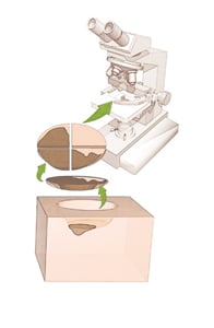 Illustration af vævet, der deles og undersøges i mikroskop